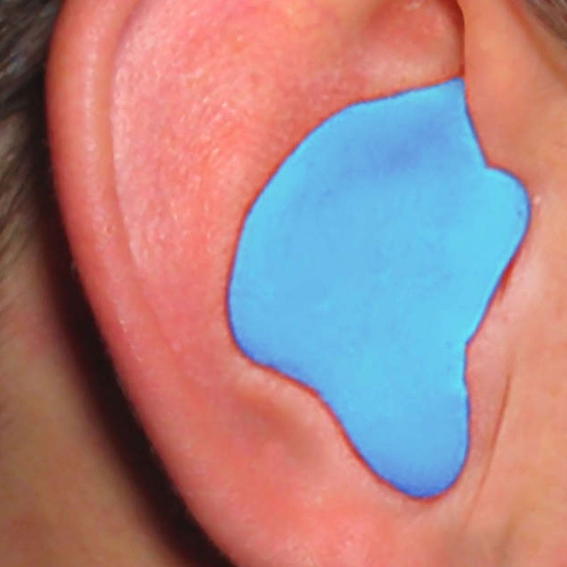 Custom Molded Ear Plugs, Blue, NRR 26 dB